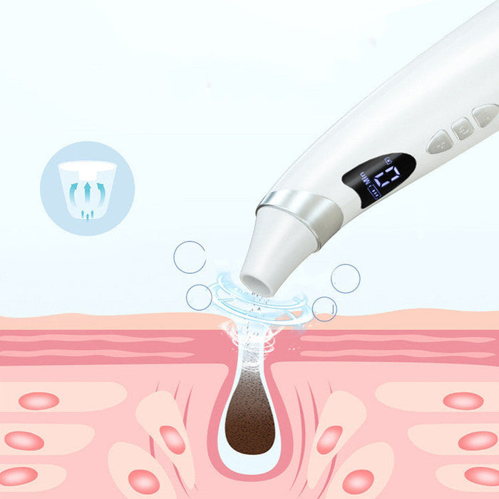 Electric blackhead suction tool for skin care - essentialdailypicks