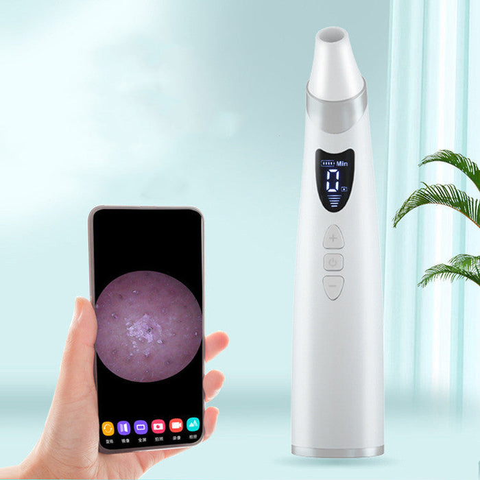 Electric blackhead suction tool for skin care - essentialdailypicks